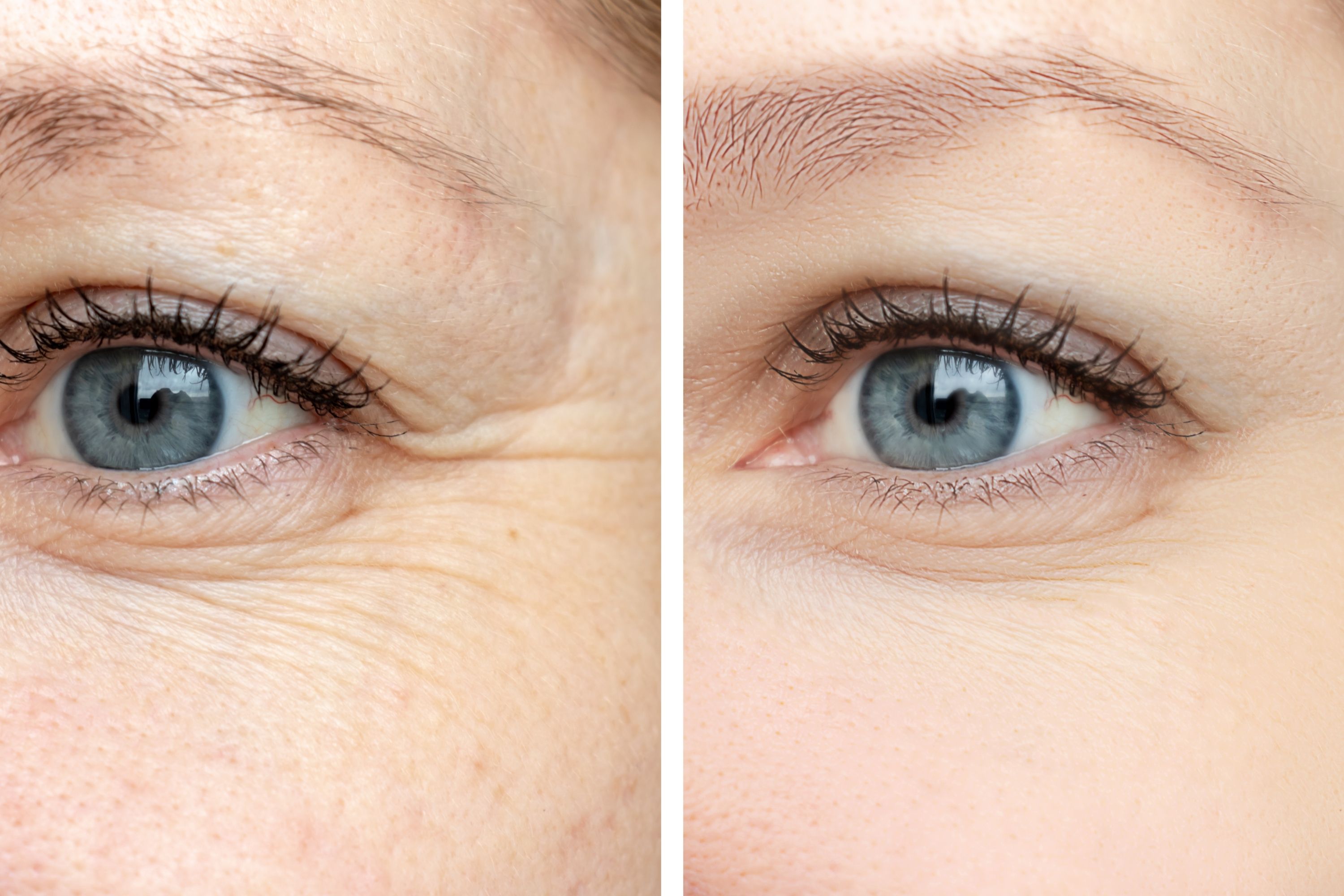 Hautpflege/Skin Rejuvenation